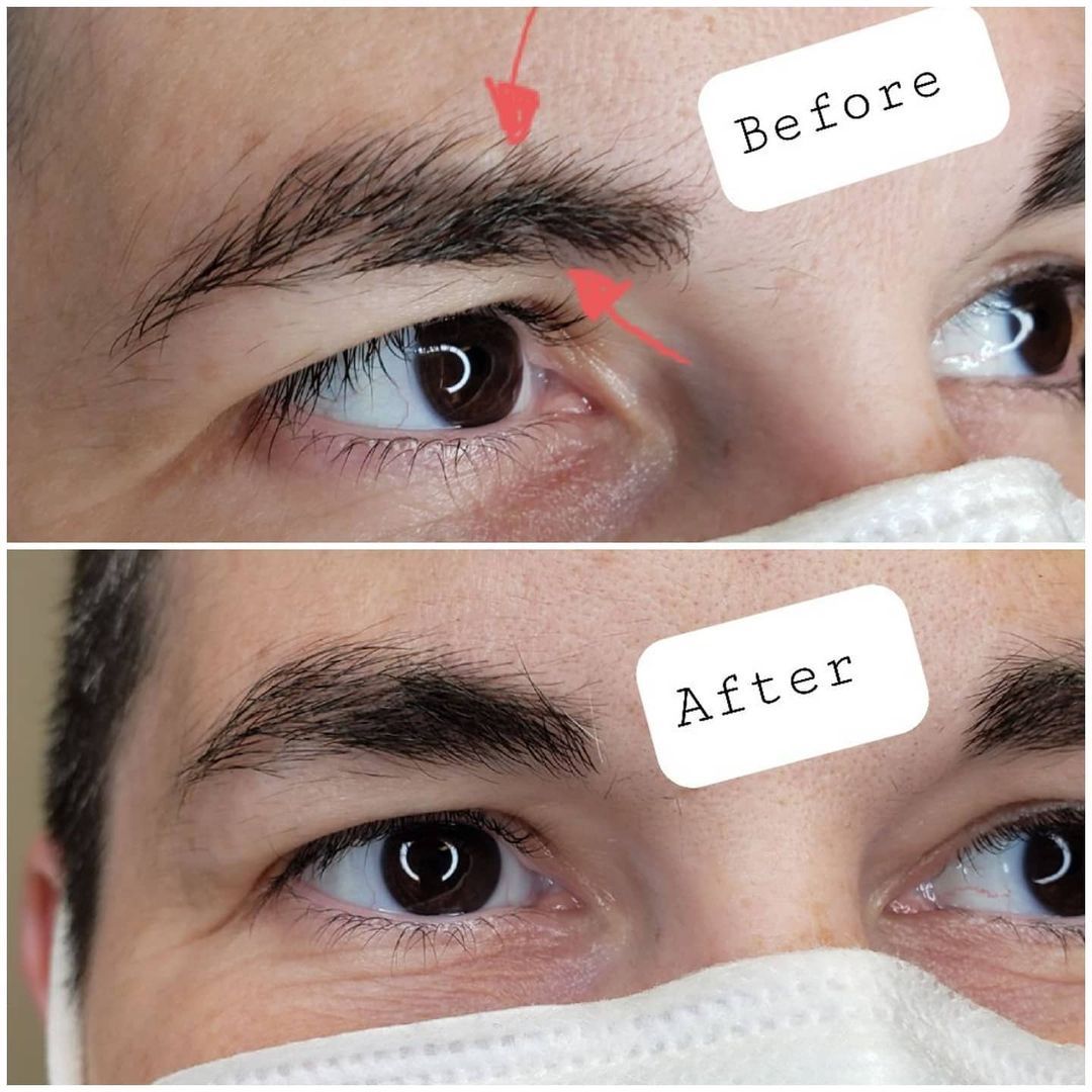 Brow transformation before and after
